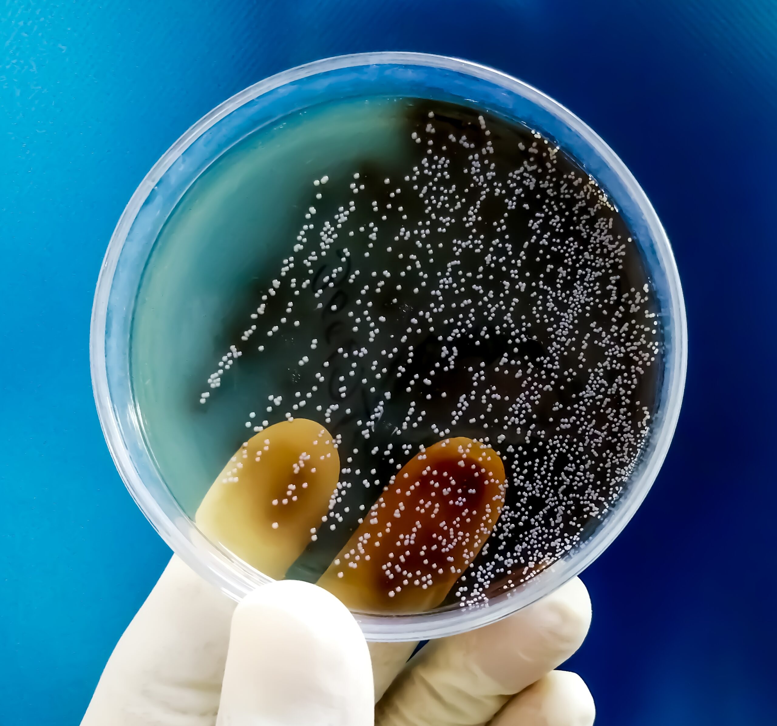 Candida Culture